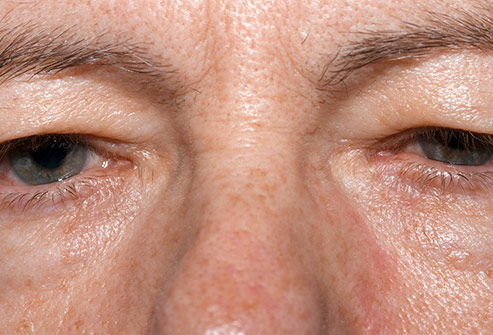 از وضعیت چشم ها وضعیت سلامتی را بفهمید از وضعیت چشم ها وضعیت سلامتی را بفهمید