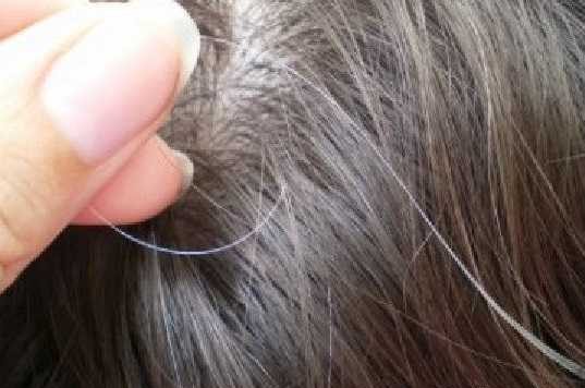 چه عواملی باعث سفید شدن موی سر در سنین مختلف می شود؟
