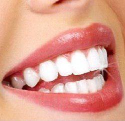 آیا برای ردیف کردن دندانها تنها راه ارتودنسی است؟ آیا برای ردیف کردن دندانها تنها راه ارتودنسی است؟