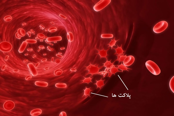 معرفی غذاهای پلاکت ساز برای رفع کمبود پلاکت خون