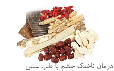 ناخنک چشم ناخنک چشم