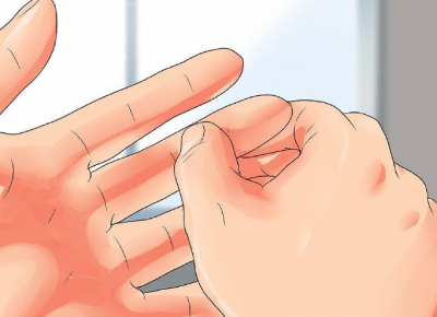 رگ به رگ شدن رگ به رگ شدن