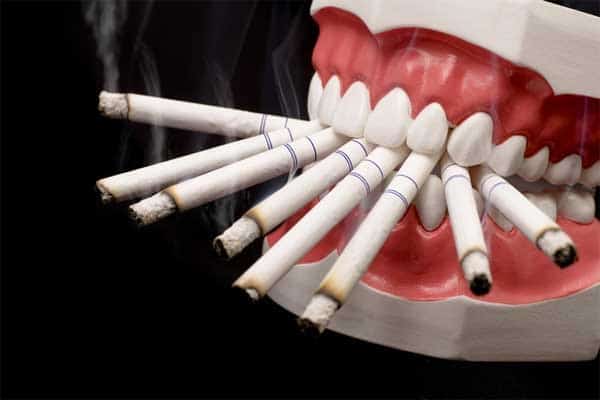اثرات سیگار بر روی ایمپلنت