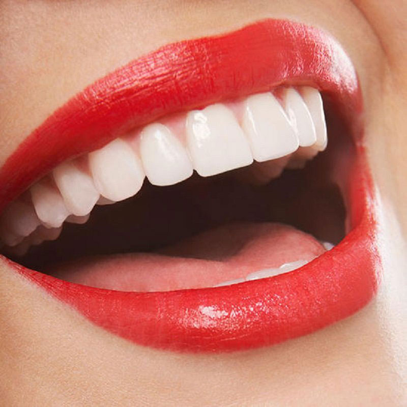 راه‌هایی برای داشتن دندان‌های سفید و درخشان