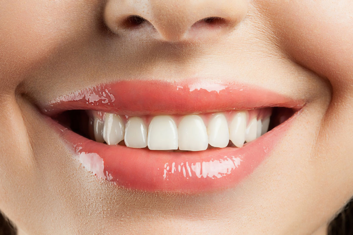 راه‌هایی برای داشتن دندان‌های سفید و درخشان