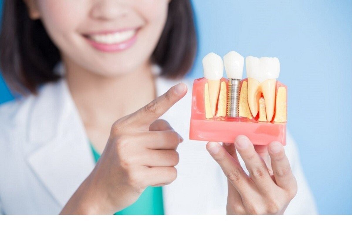 ویژگی‌های یک دندانپزشکی خوب برای اجرای ایمپلنت دندان